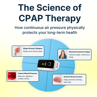 iBreeze Auto CPAP